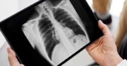 A New Normal Offers New Ways To Quit.